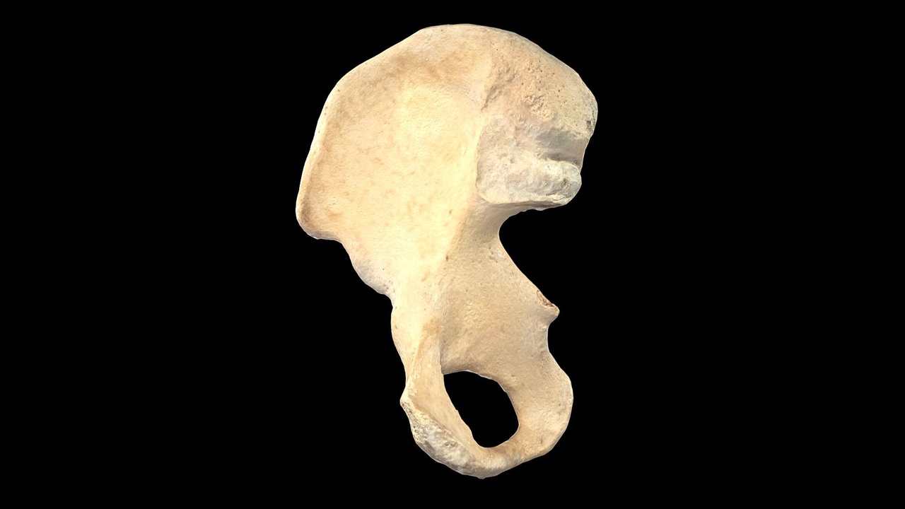Media 1 for listing Hip Bone Photogrammetry