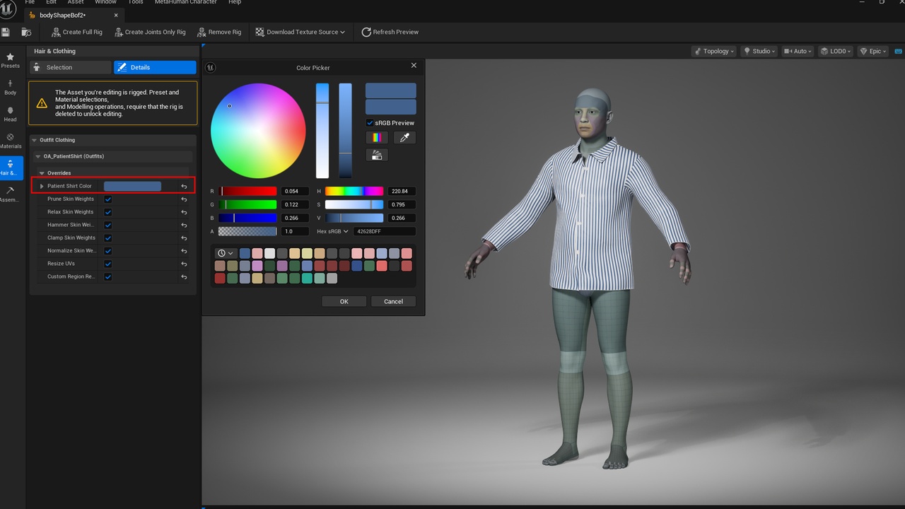 Media 1 for listing Patient Shirt - Metahuman Patient Top Clothes - Parametric Outfit PBR