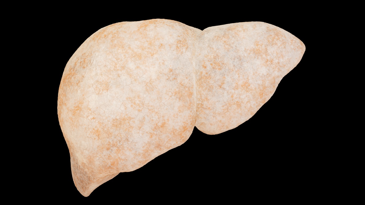 Media 1 for listing Liver fibrosis, liver disease, digestive system organs