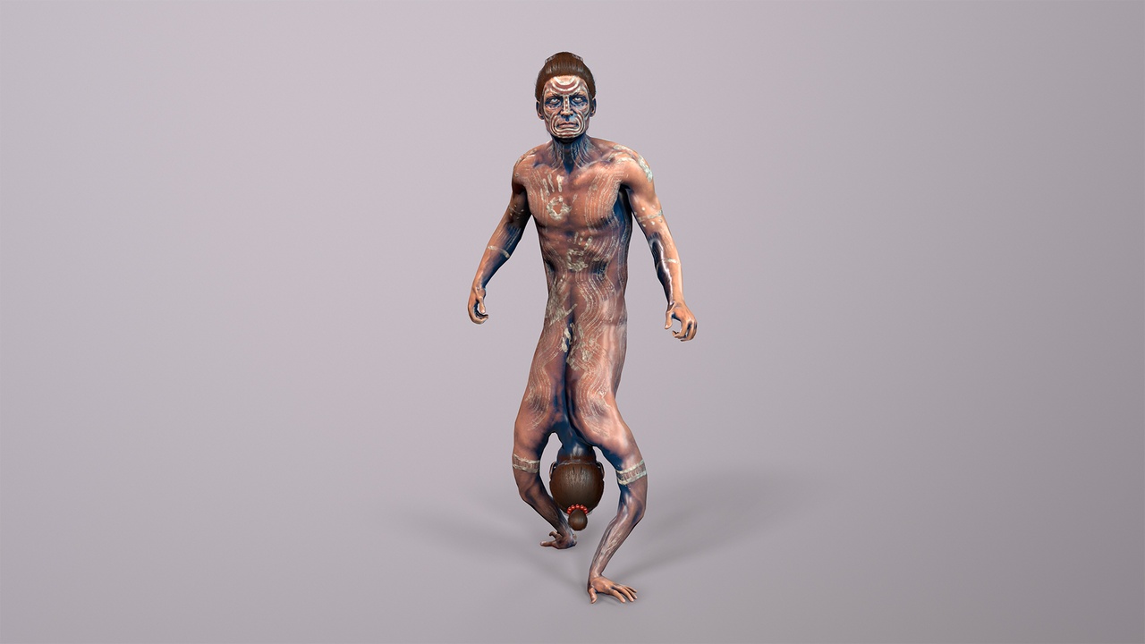 Media 1 for listing Siamese_twins