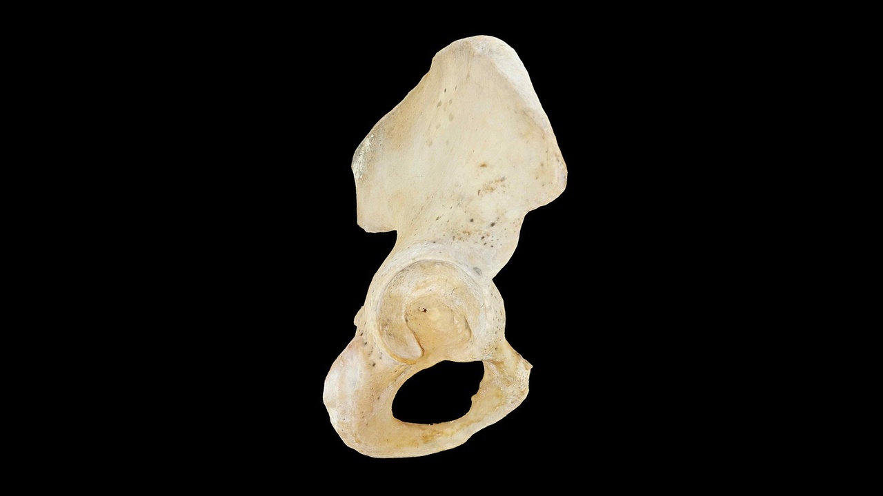 Media 1 for listing Hip Bone Scanned