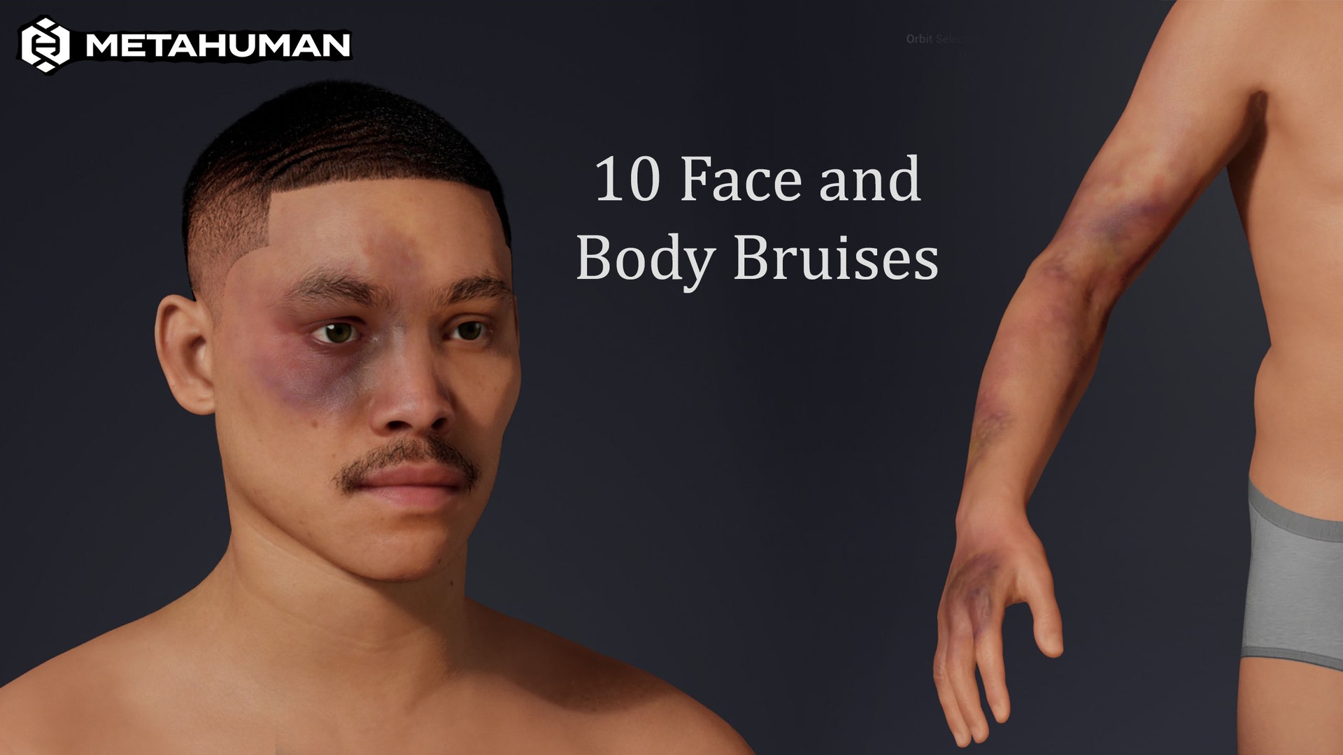 Media 1 for listing Bruises Black eye Texture - Editable MetaHuman
