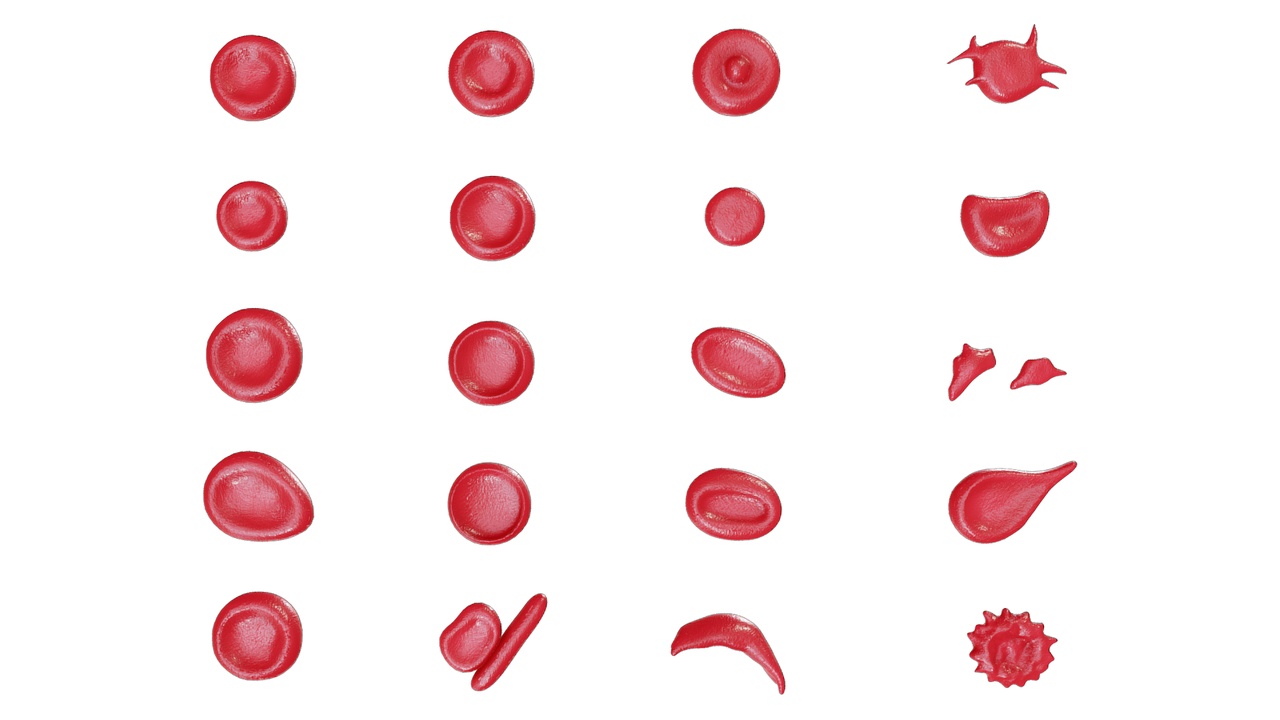 Media 1 for listing Red Blood Cell Morphology Normal and Abnormal Erythrocyte Structures