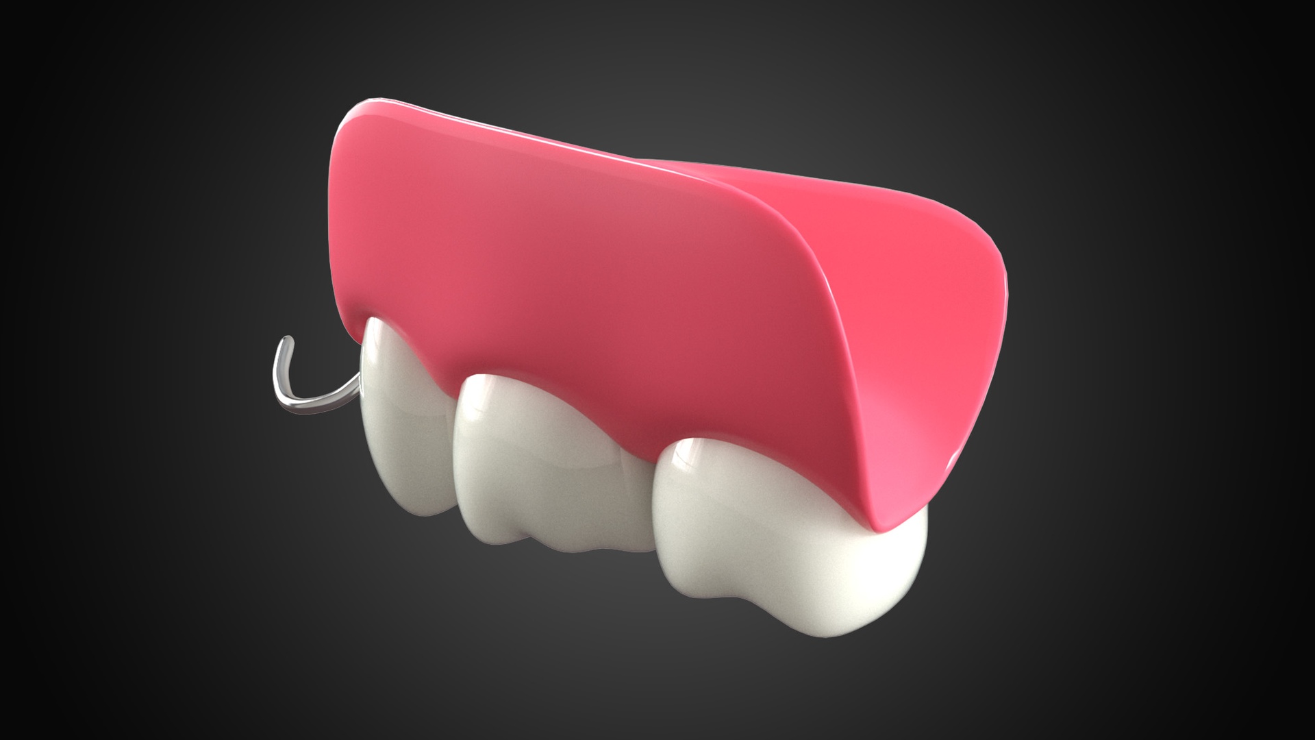 Media 1 for listing Removable Partial Denture
