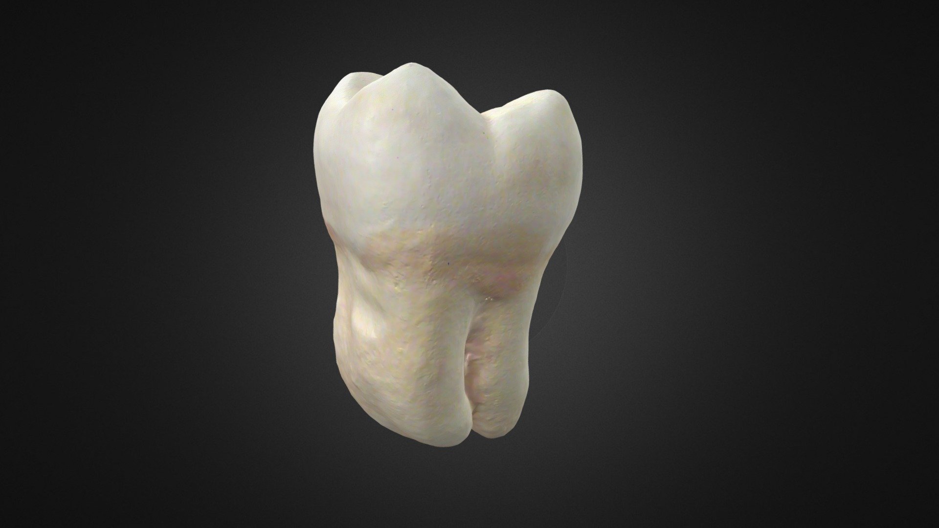 Primer Molar | Fab