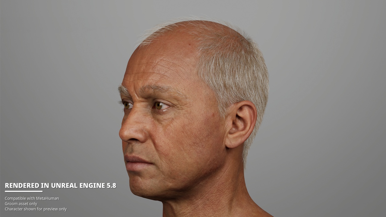 Media 1 for listing Advanced Male Pattern Baldness – Short Senior MetaHuman Groom