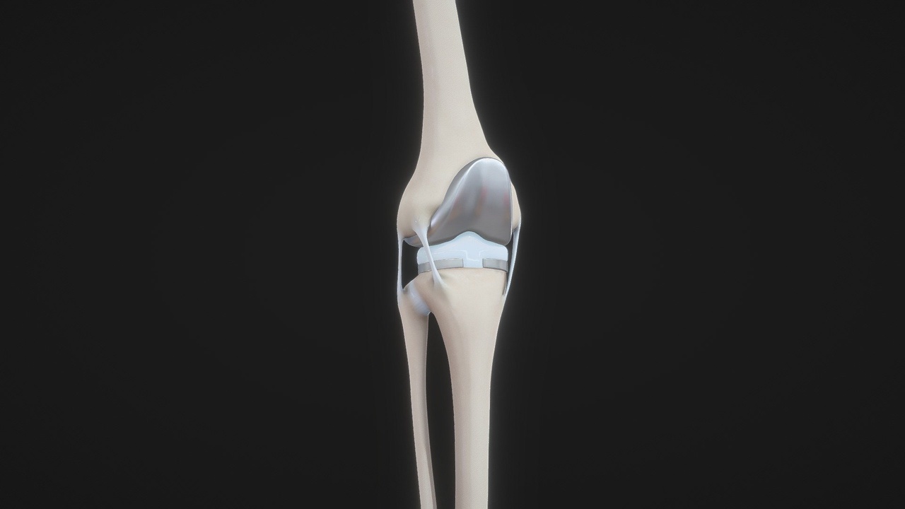 Media 1 for listing Knee Replacement