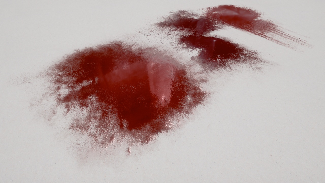 Media 1 for listing Blood: Splashes