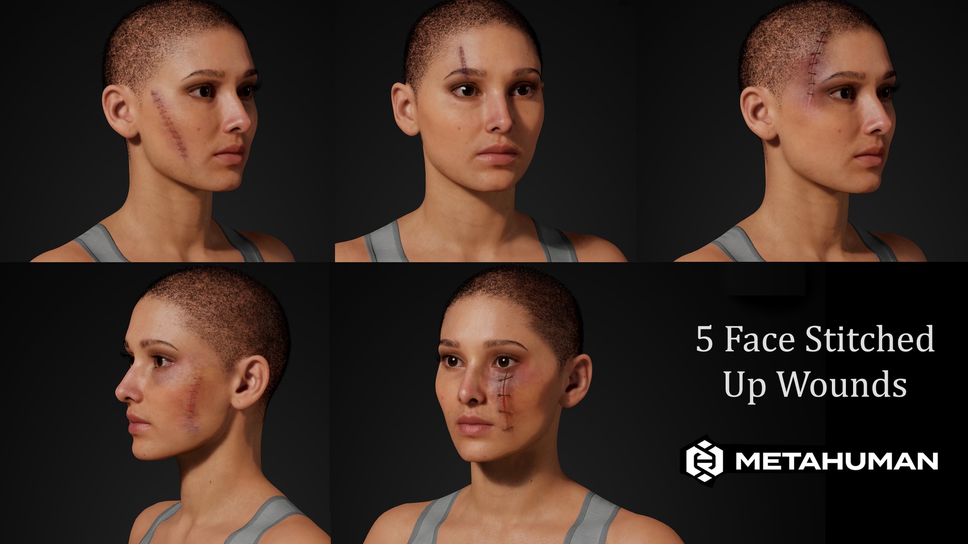 Media 1 for listing Stitched Up Wounds Scars on Face Texture - Editable MetaHuman
