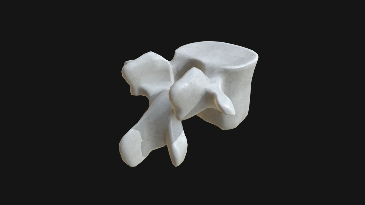 Media 1 for listing Anatomy - Lumbar vertebra