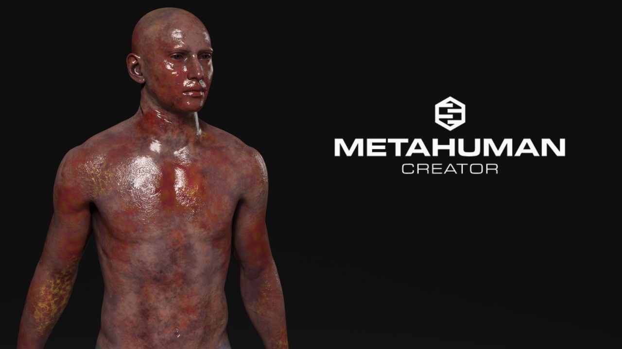 Media 1 for listing Zombie Infection Texture Pack – 9 Custom 4K Variants - Metahuman