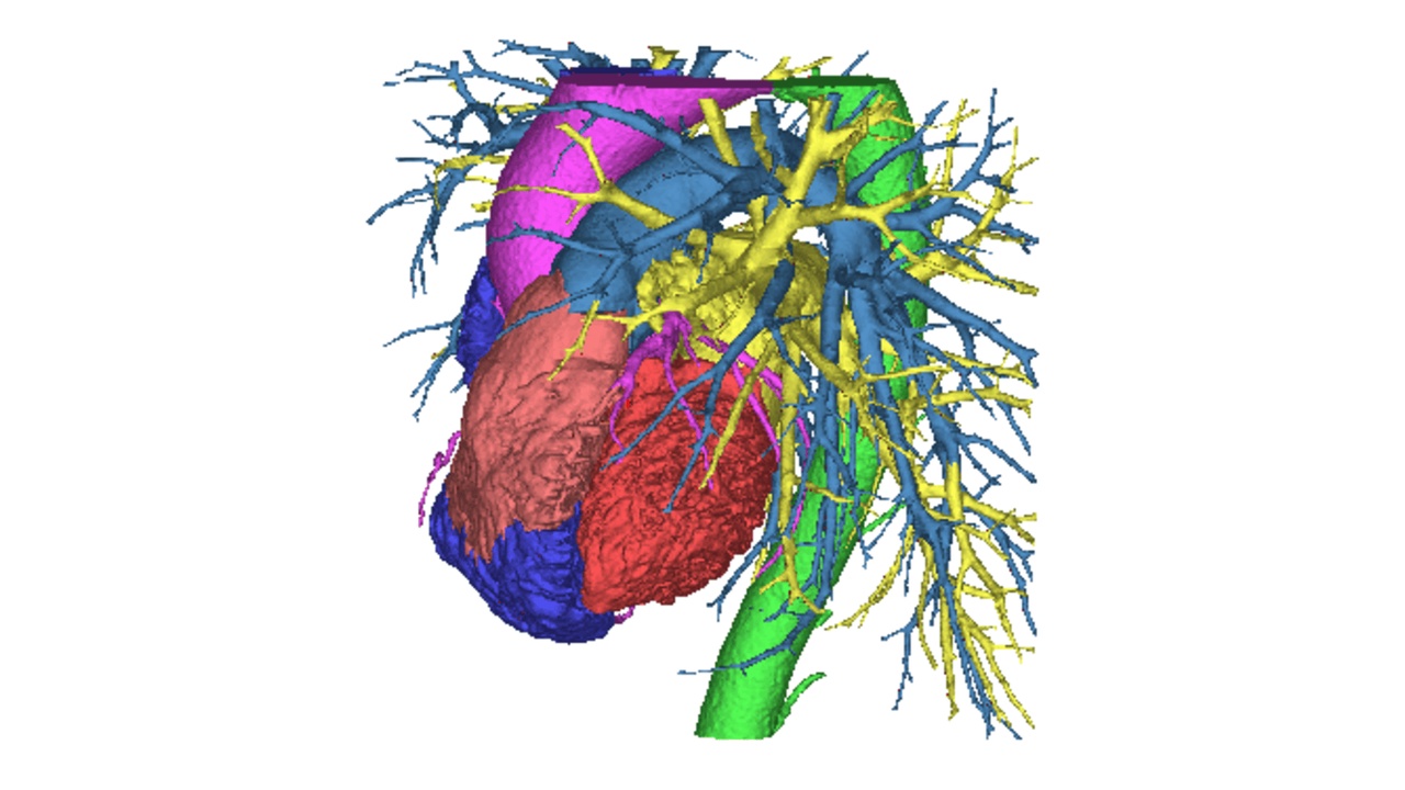 Real Heart Image Dissection Heart Reconstruction | Fab