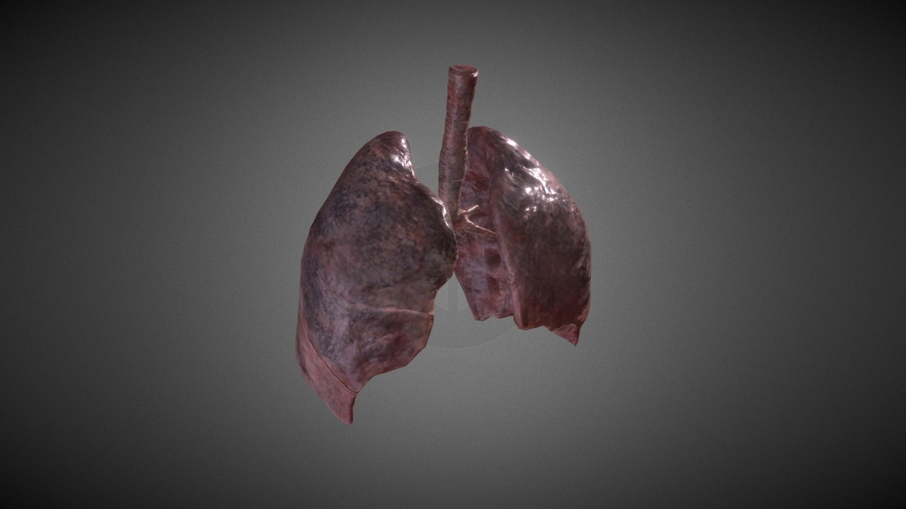 Media 1 for listing Smoker's Lungs (animated)