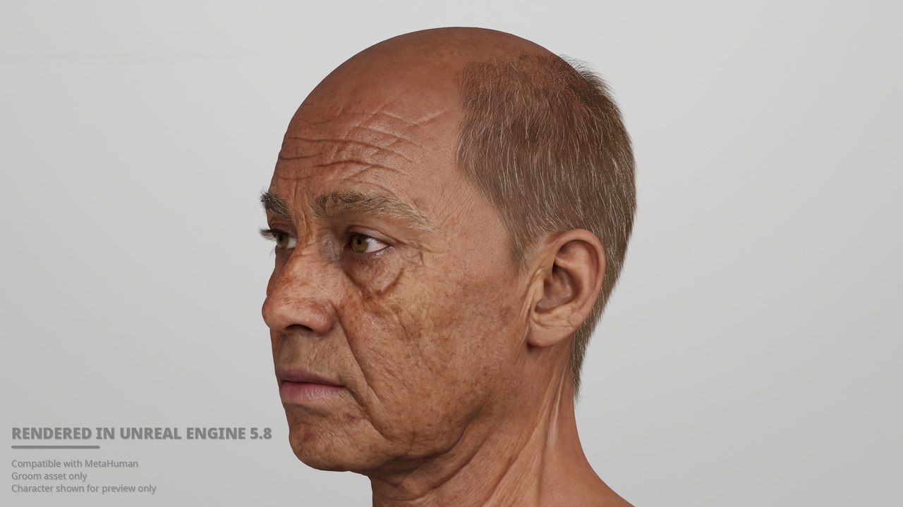 Media 1 for listing Advanced Male Pattern Baldness – Short Horseshoe Hair MetaHuman Groom