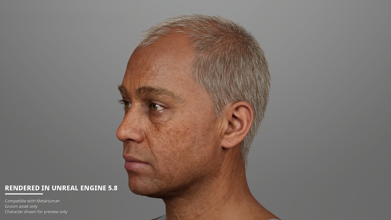 Media 1 for listing Short Diffuse Male Pattern Baldness – MetaHuman Groom