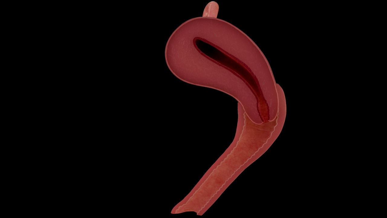 Media 1 for listing Anatomy of a healthy uterus, female ovaries, vagina, uterus, and fallopian tubes