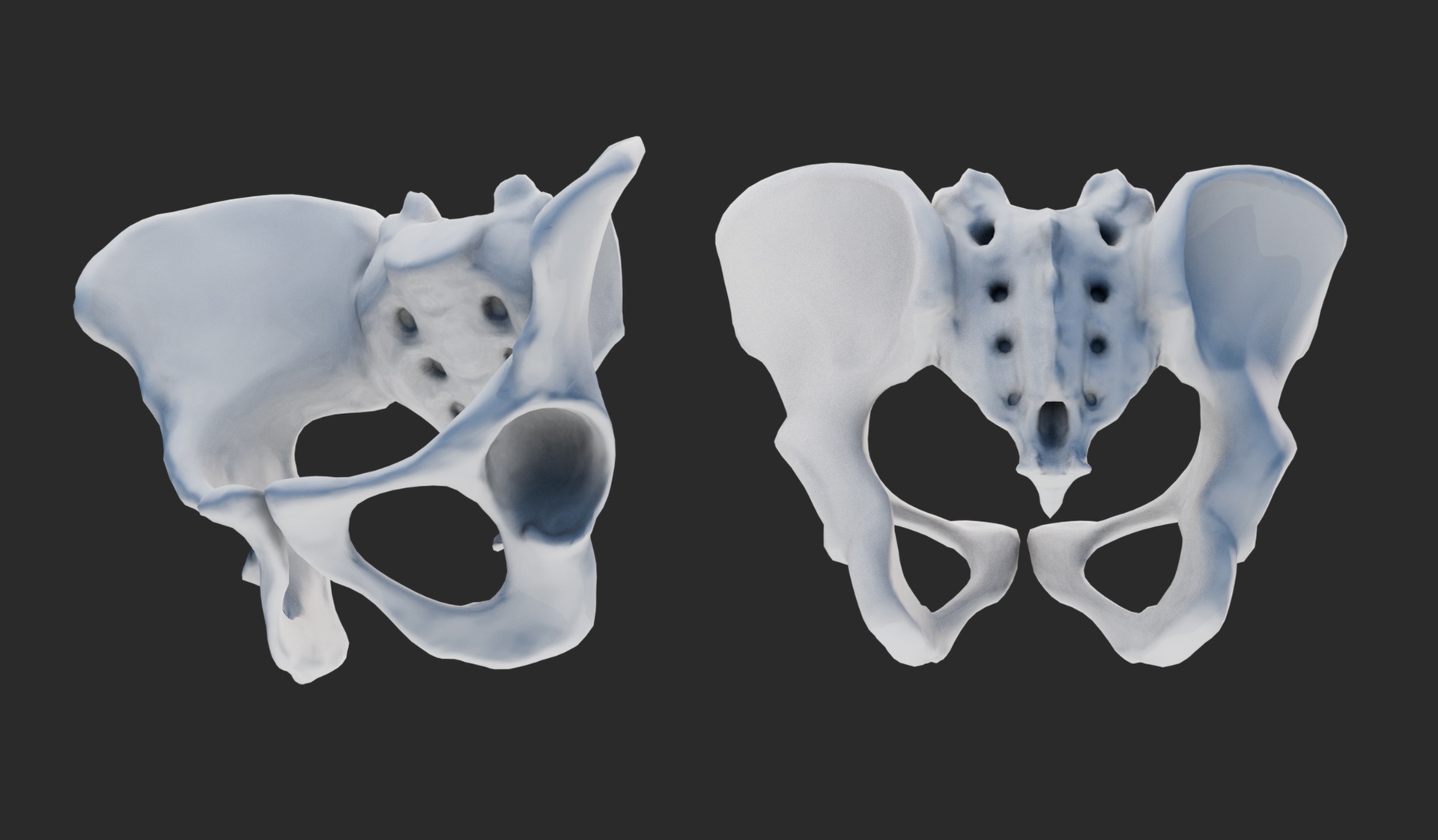 Media 1 for listing Female Pelvis
