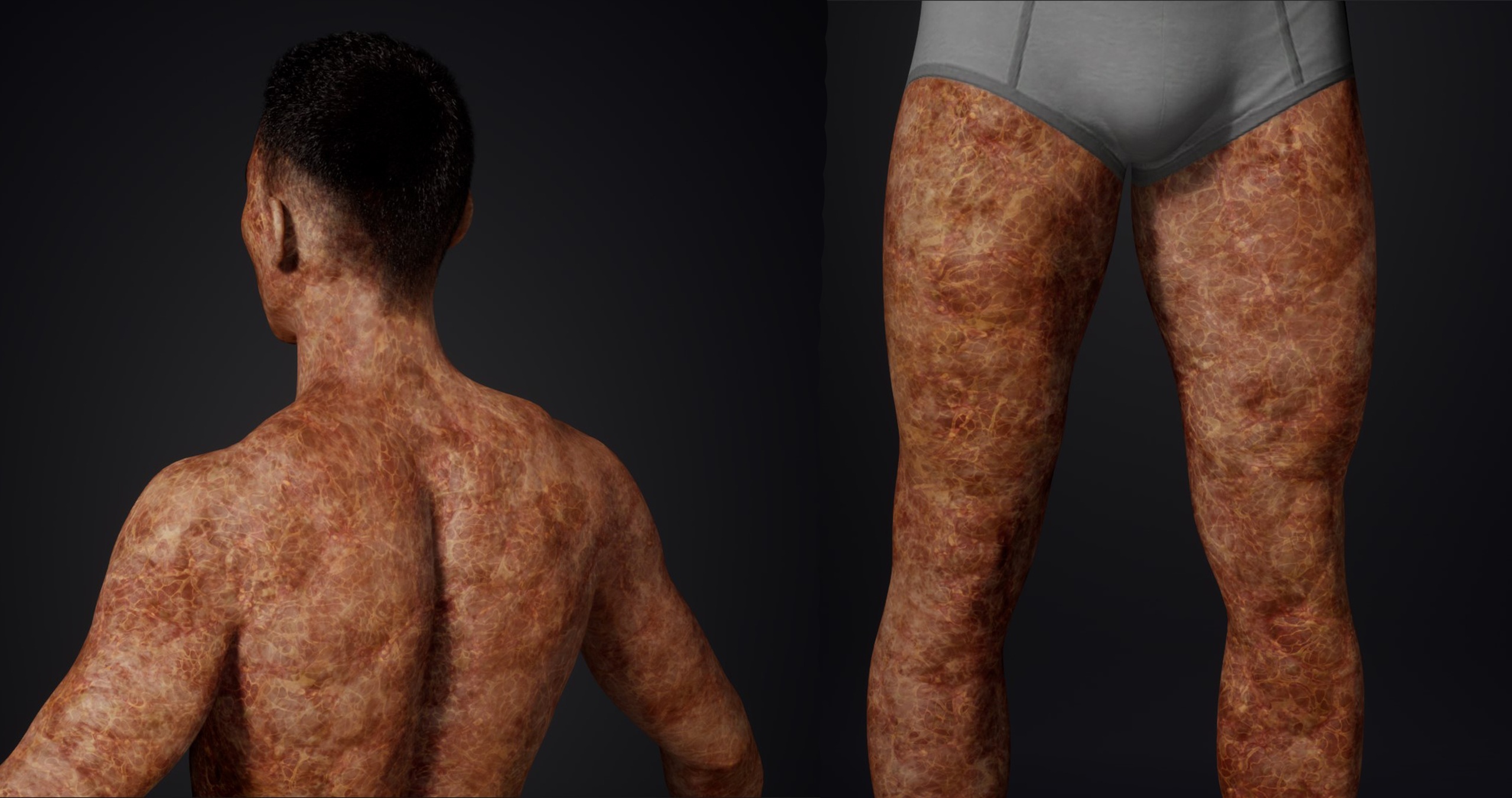 Media 1 for listing Horror Zombie Texture - Editable MetaHuman