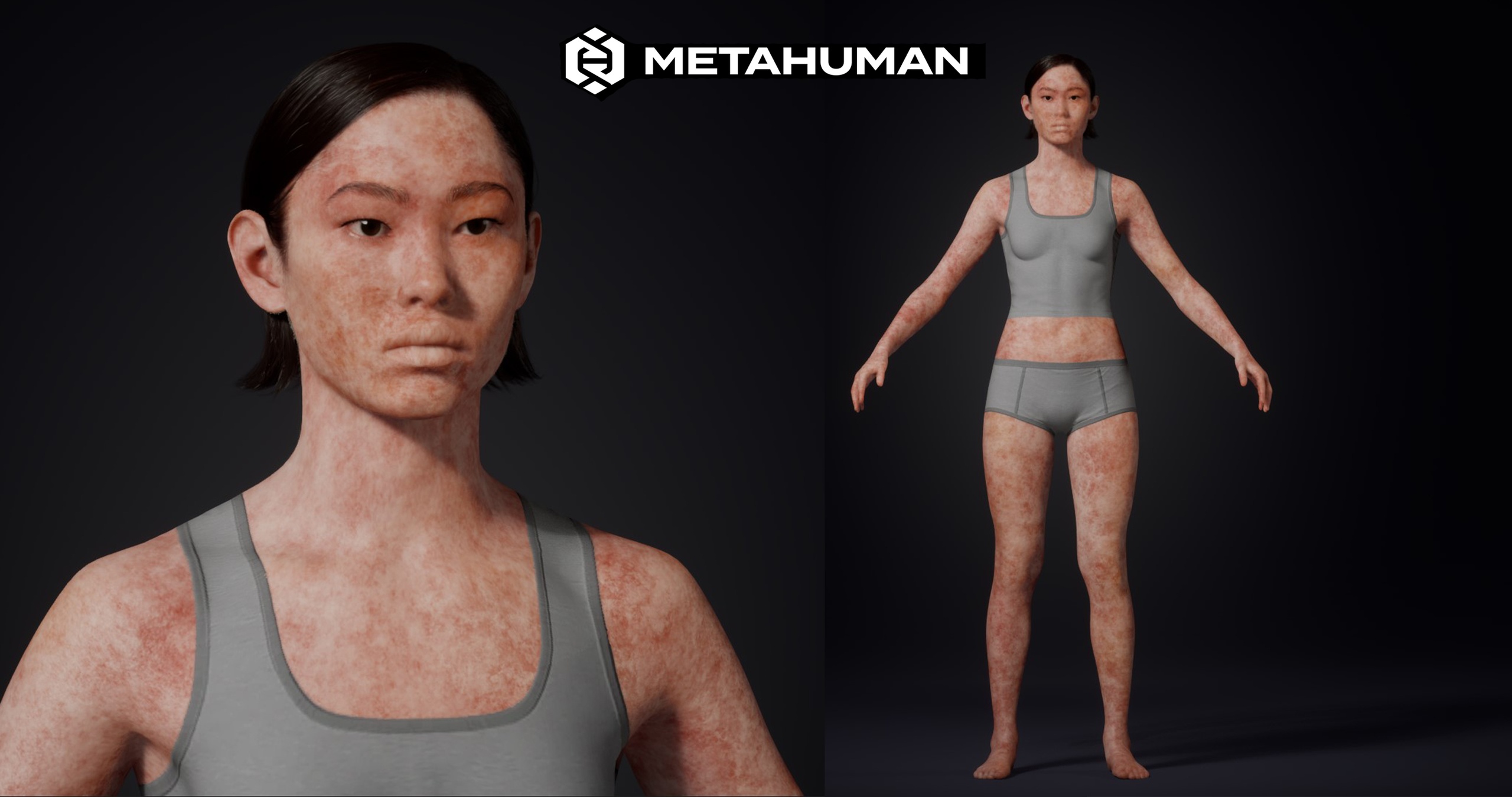 Media 1 for listing Burnt Wounded Texture - Editable MetaHuman