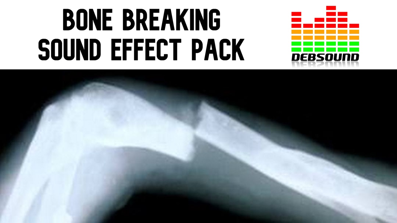 Media 1 for listing Bone Breaking Sound Effect Pack