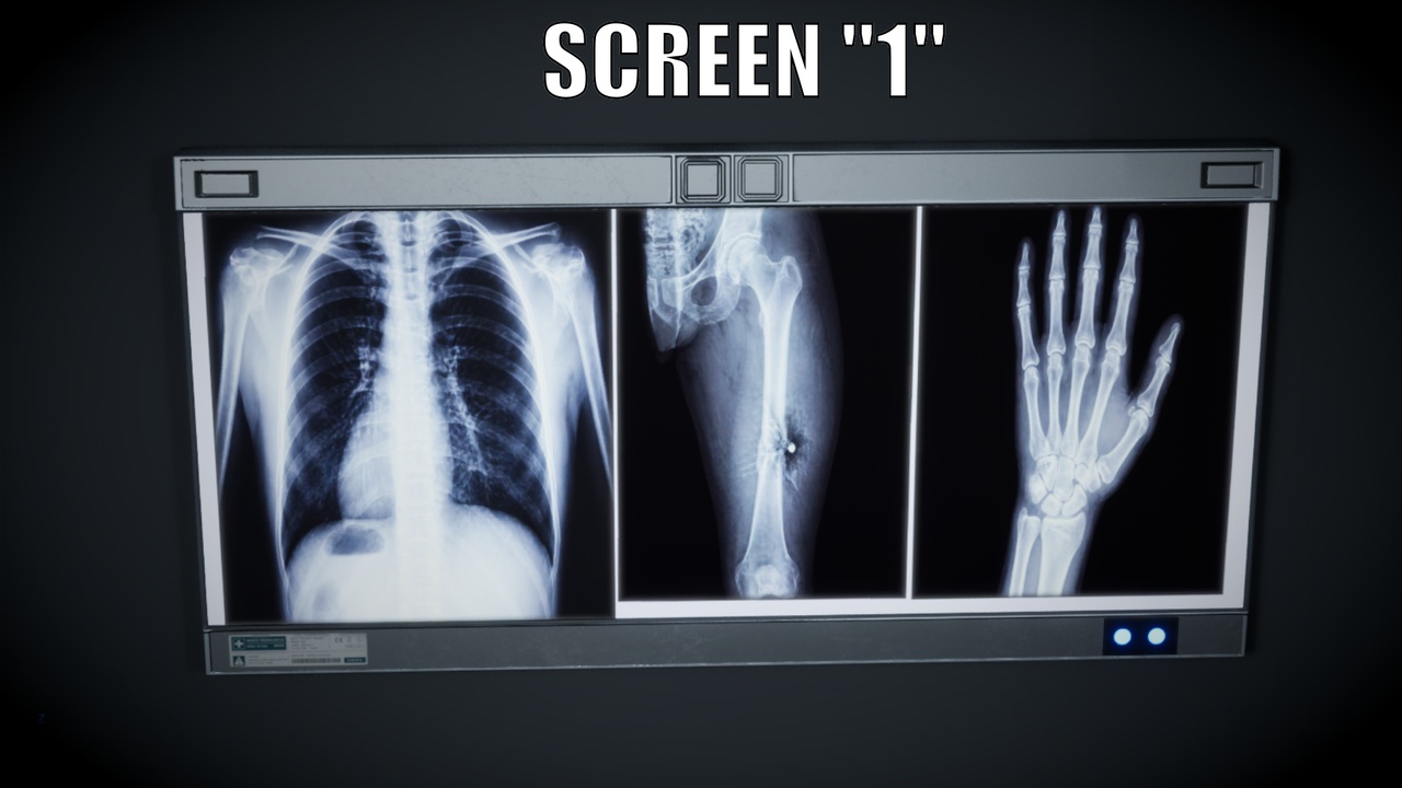 Media 1 for listing Medical X-Ray Lightbox