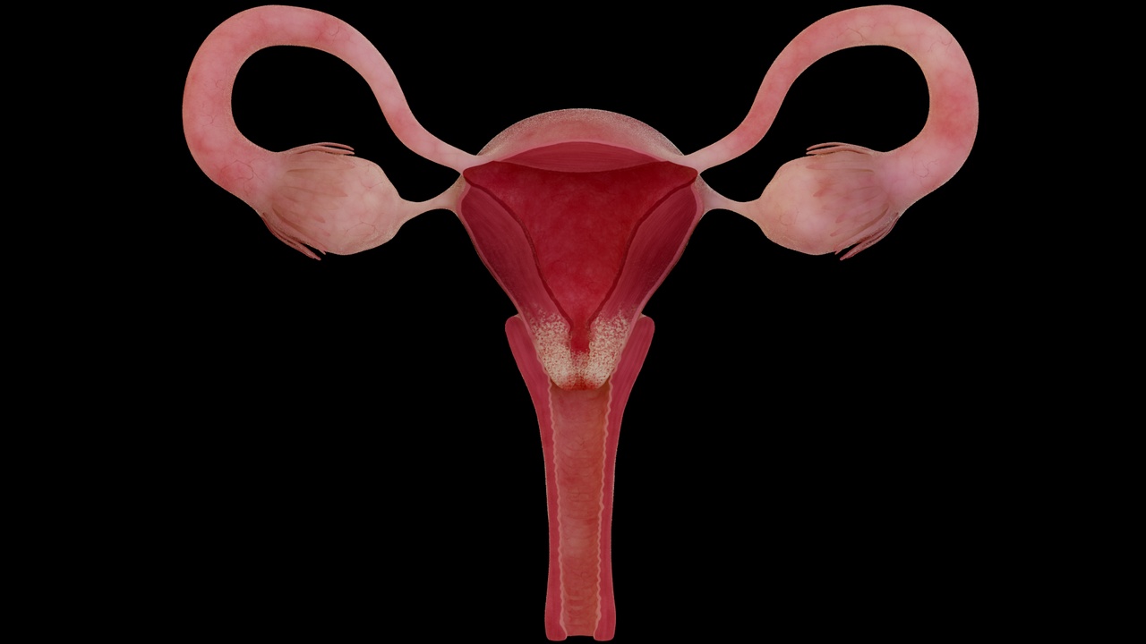 Media 1 for listing Cervical erosion, cervical cancer, uterine diseases
